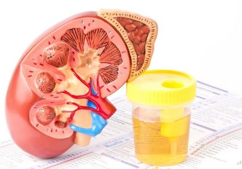 Illustration of a kidney and a pot of urine